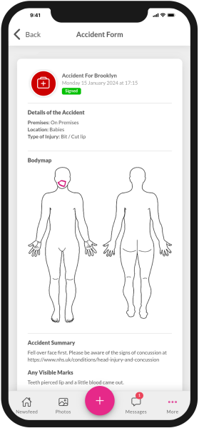 Accident forms on the Nursery in a Box app